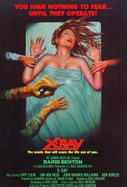 Watch Free XRay (1981)